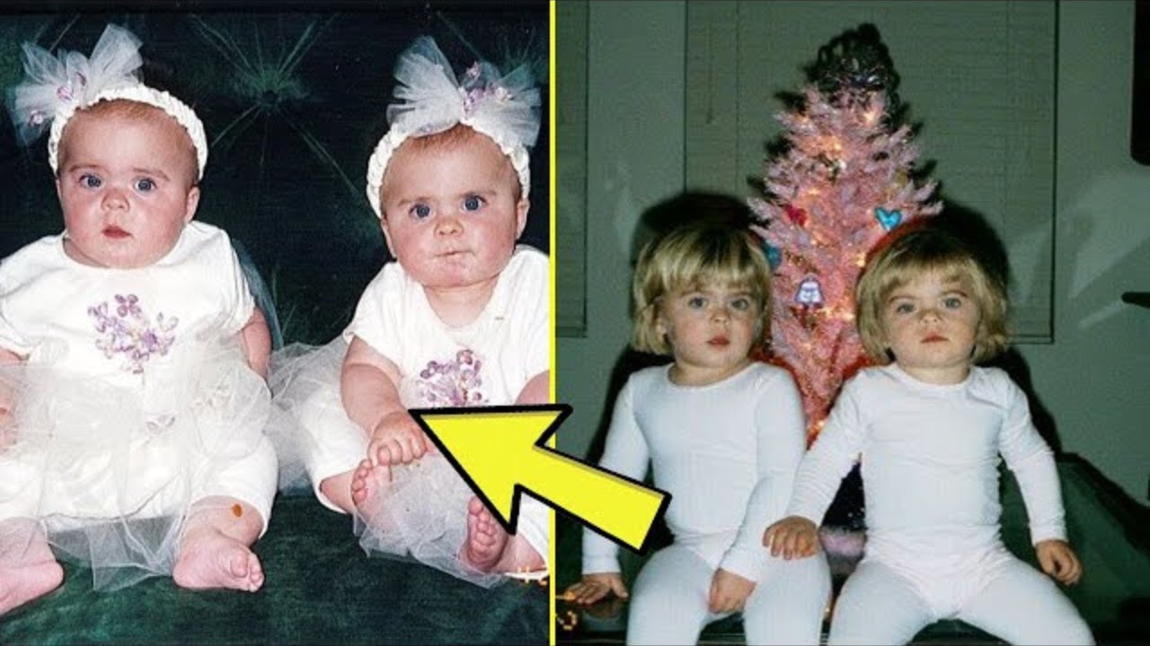 Kur mjeku më tha ‘Tani janë’” – Historia prekëse e një nëne që zbuloi diçka të jashtëzakonshme gjatë shtatzënisë me binjakë