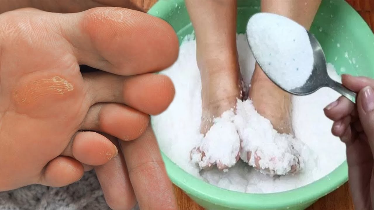 Mjekët na e kanë mbajtur të fsheht. Futini këmbët në ujë me sodë dhe do habiteni nga ajo që do ndodh