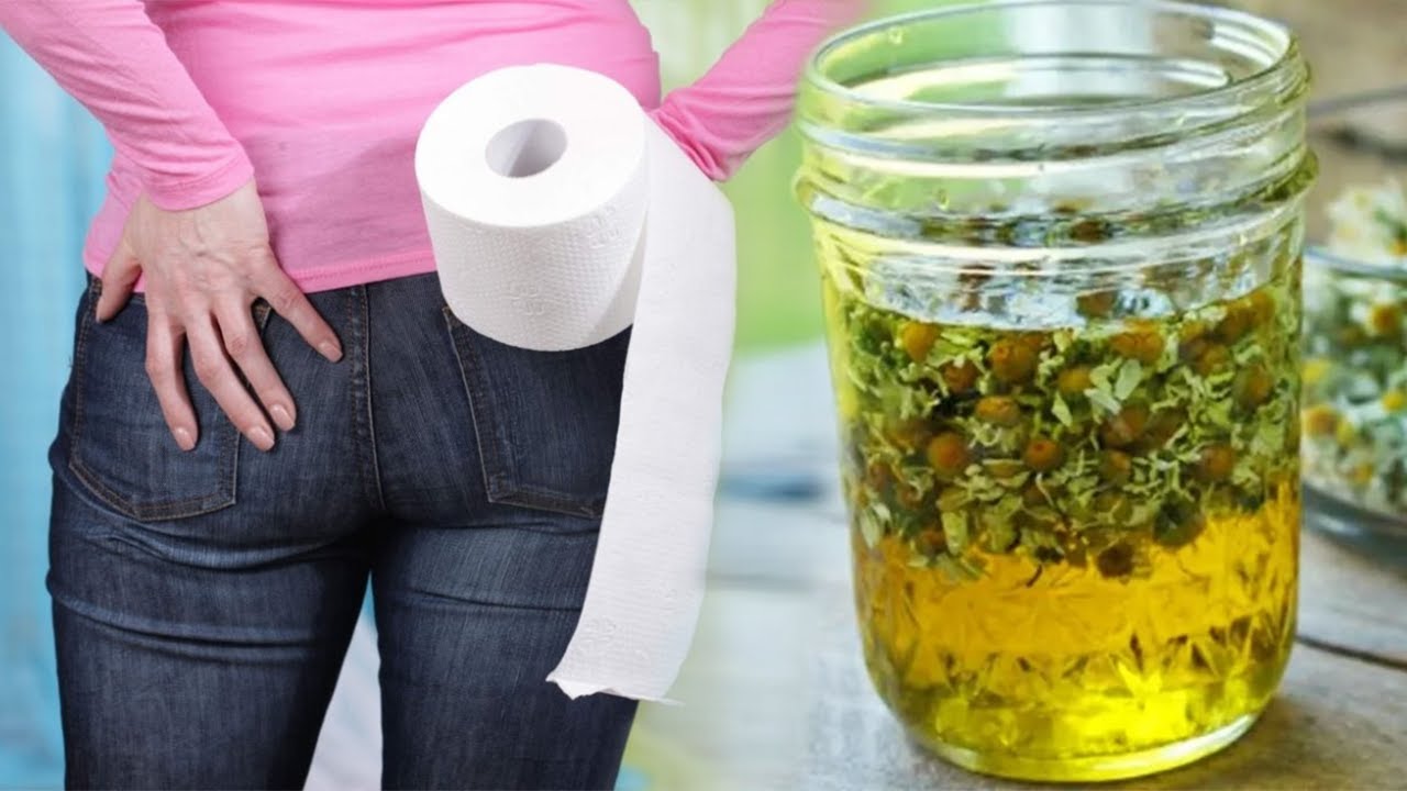 Mjekët e mbajnë sekret. Zbulohet receta që shëron hemorroidet përgjithmonë