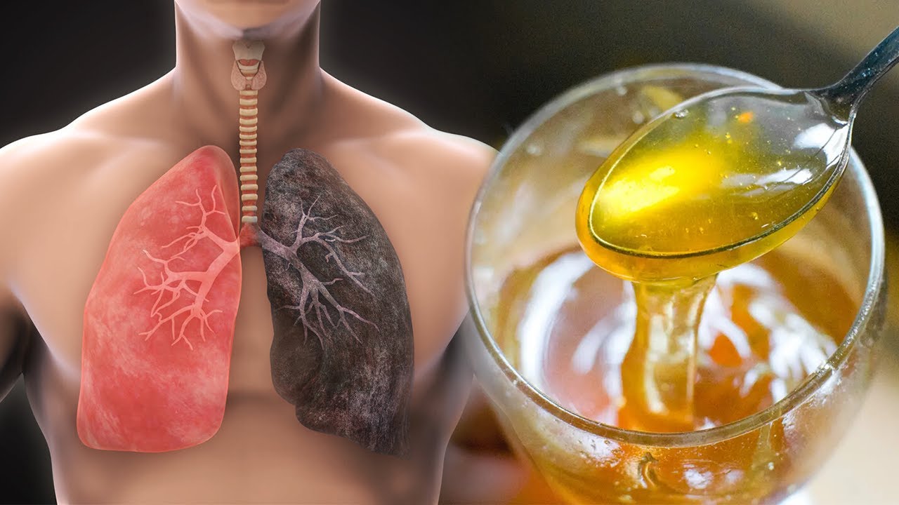 Më në fund u gjet zgjidhja: Largoni kollën, pastroni mushkëritë nga gëlbaza vetëm me këto 2 përbërës