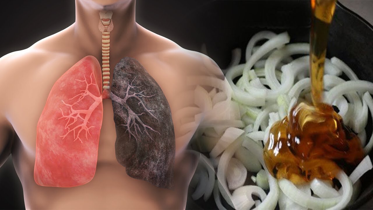 Ja si të zhdukni kollën dhe të pastroni mushkëritë nga gëlbaza për 72 orë, do befasoheni