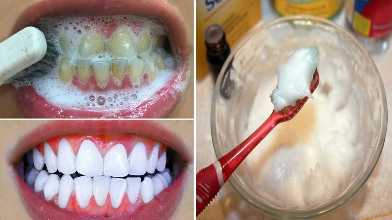 Ju qelbet goja erë? Ja s’i të shpëtoni nga ky problem përgjithmonë në vetëm 5 minuta