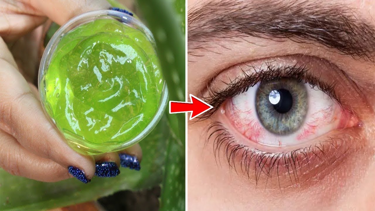 Keni probleme me sytë dhe nuk shikoni qartë? Ja receta që përmirëson shikimin