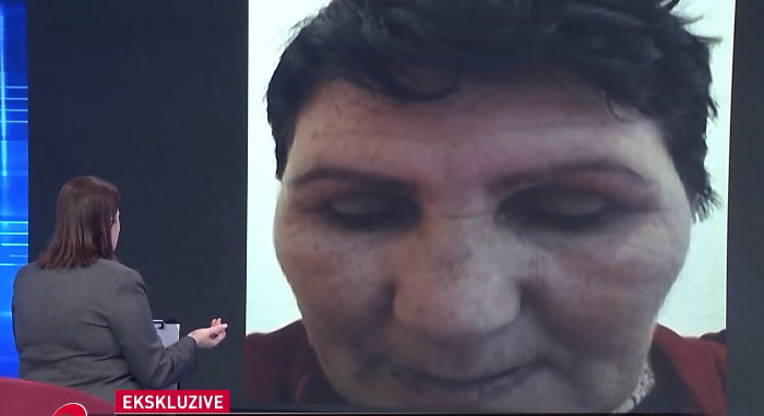 Ngacmimi i të miturës në Fier/ Trondit gjyshja: Krushku është k***ar, më fërkoi sh*lët. E kishte coptuar mbesën..