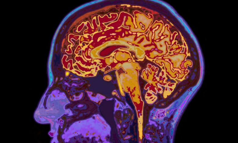 Shkencëtarët zbulojnë pse njerëzit nuk mund të përqendrohen pas një nate pa gjumë