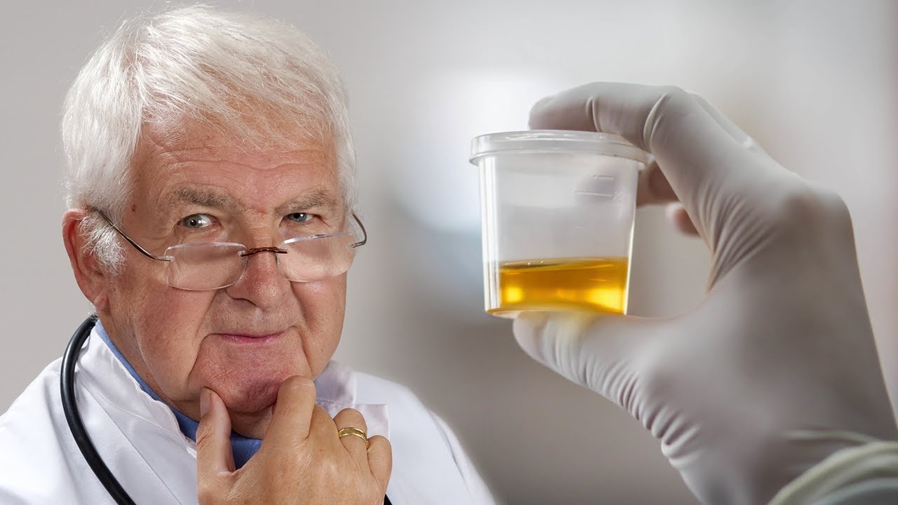 Mjeku “çudit” botën: Ngjyra e urinës tuaj mund t’ju tregojë këto sëmundje