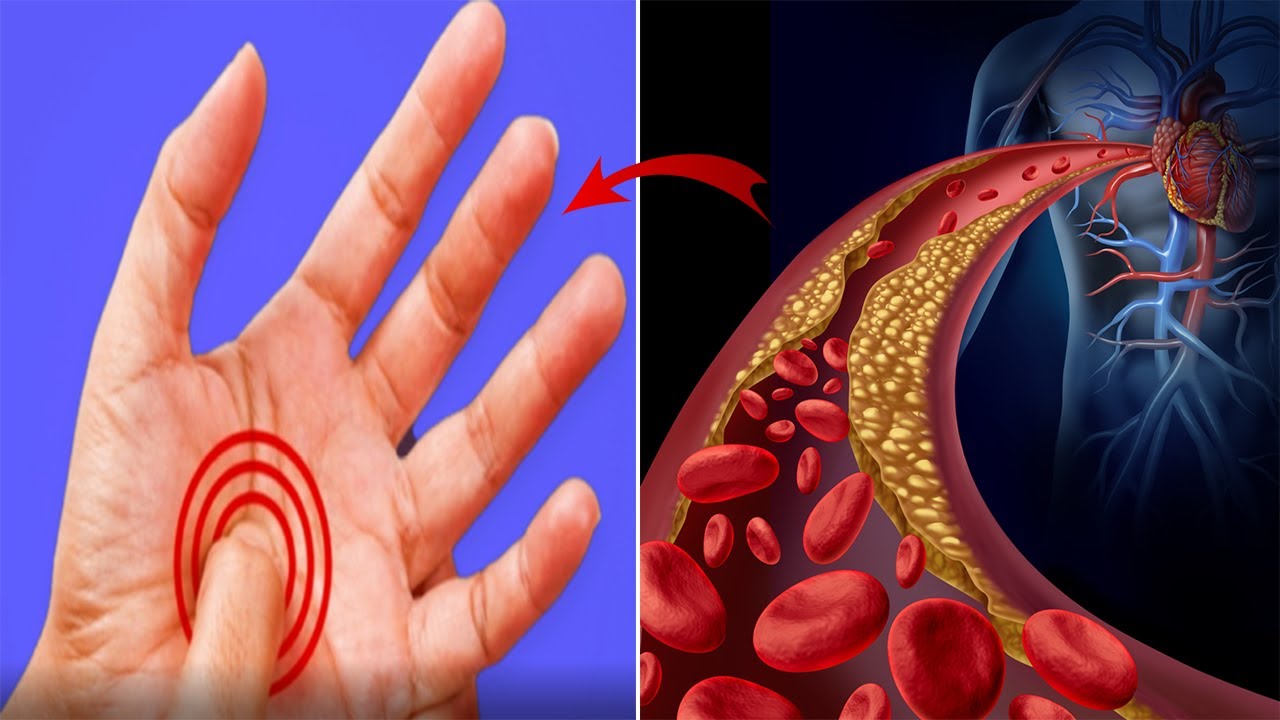 Këto janë shenjat që trupi ju jep kur keni kolesterol të lartë, ja si ta kuroni