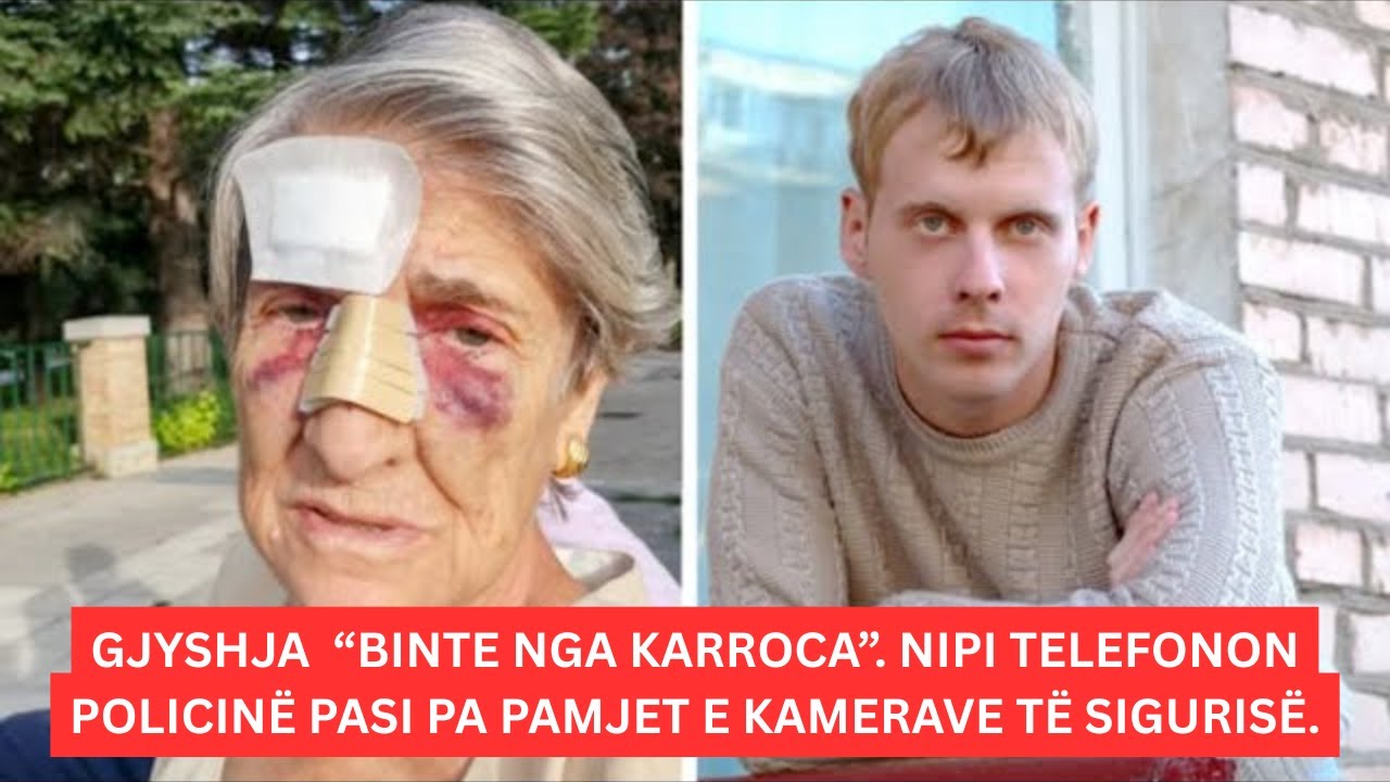 Gjyshja “binte nga karroca me rrota”. Nipi telefonon policinë pasi pa pamjet e kamerave të sigurisë!