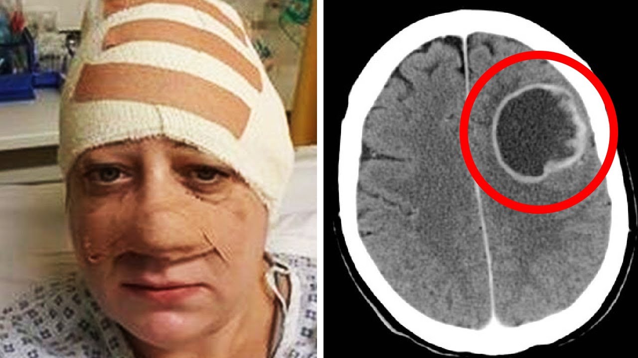 Pacientët që përjetuan kimioterapinë ndajnë përvojat emocionuese dhe të vështira nga trajtimi