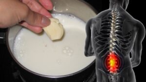 Mjeku “çudit” botën: “Përzjeni këto 2 përbërës çdo ditë dhe do shpëtoni nga nervi shiatik”