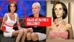 Ajo peshonte 26 kilogram në moshën 19 vjeçare, kështu duket sot! Dikur ra pre e bullizmit!
