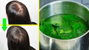 Thoni lamtumirë problemeve me rënien e flokëve, ja receta do ju habisë me rezultatin