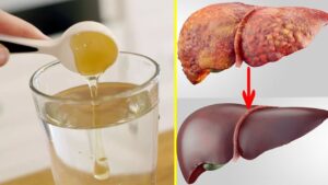 Pijeni çdo natë para se të flini dhe pastroni mëlçinë tuaj, ja mosha që duhet ta pijë “urgjent”