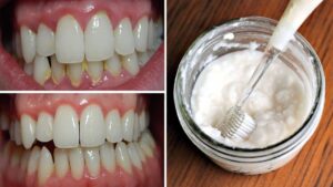 Ju vjen goja erë të keqe? Ja si të shpëtoni nga ky problem përgjithmonë në vetëm 5 minuta