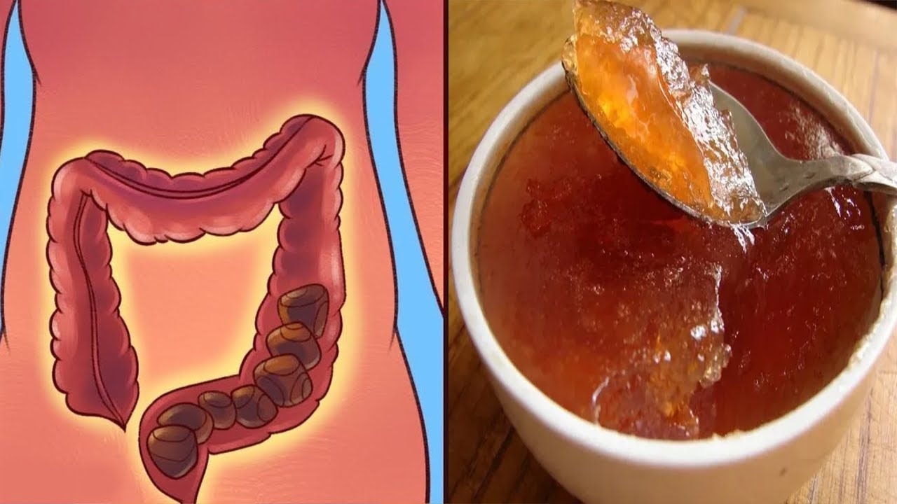 Si të largoni kapsllëkun, fryrjen dhe gazrat brenda 1 minute, kjo recetë do ju befasoj