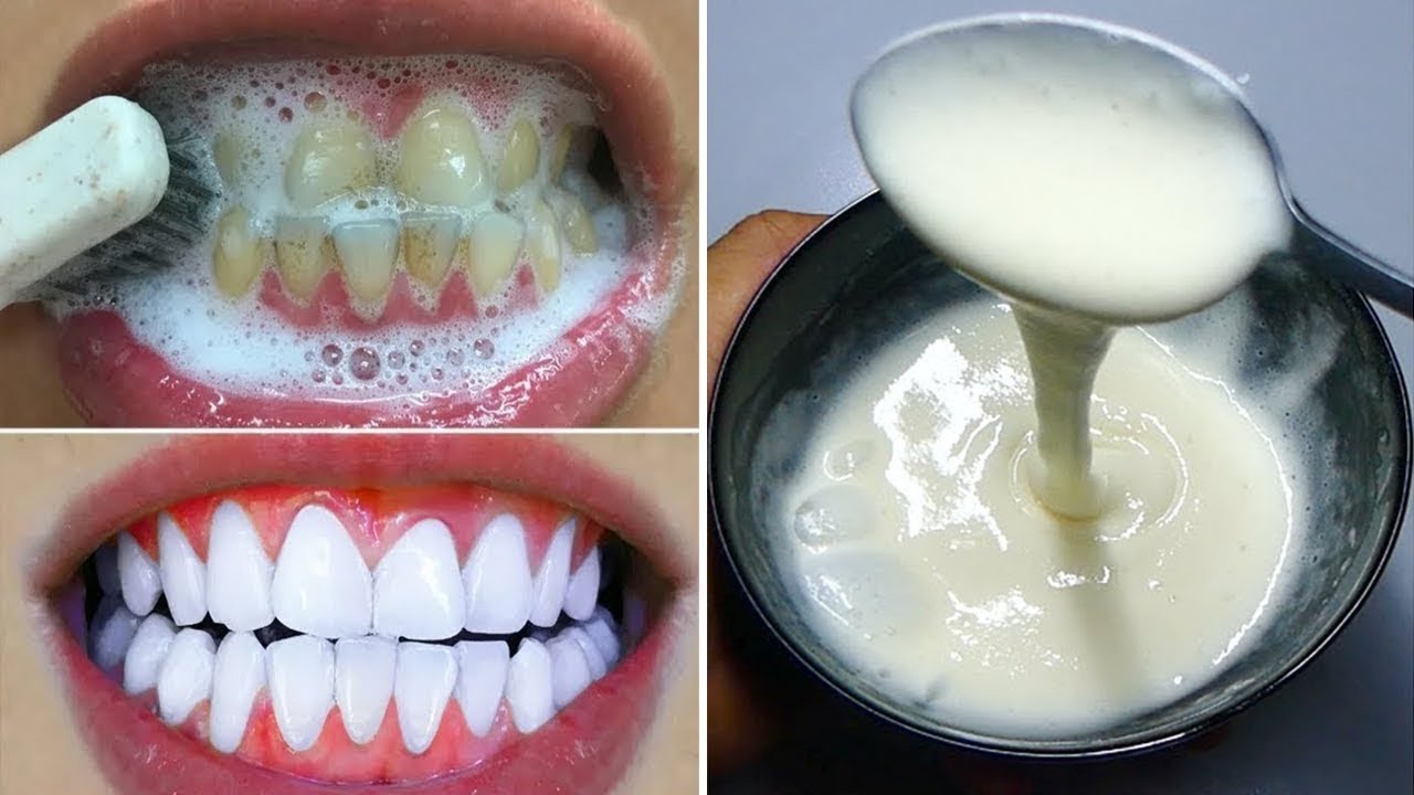Doni dhëmbë të bardhë si bora? Kjo metodë do t’ju lërë pa fjalë