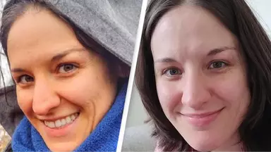 Gruaja tregon transformimin e saj të çuditshëm pas konsumimit të karotave çdo ditë – Fotot para dhe pas do t’ju lënë pa fjalë