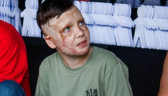 Rrëfimi që ngriti në këmbë Parlamentin Europian, 11-vjeçari ukrainas që i tha lamtumirë nënës nën rrënoja