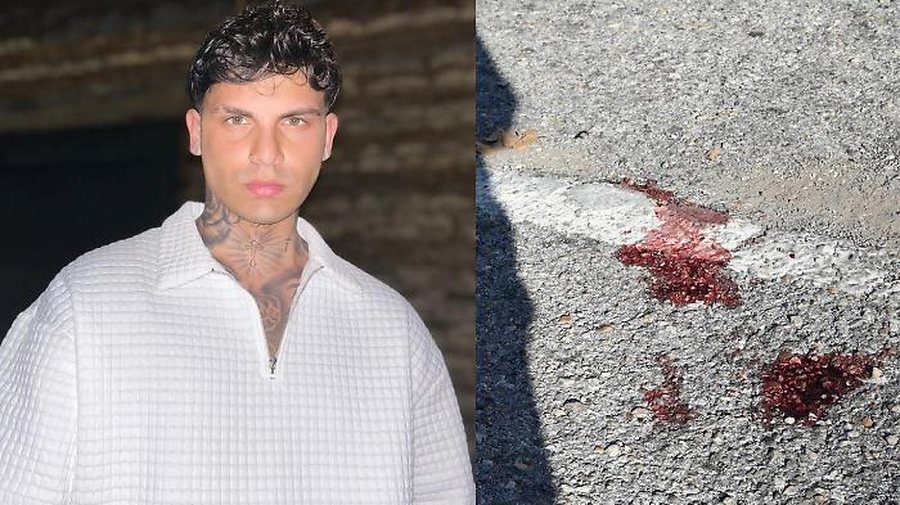 Tr*gjike në Itali! Q*llohet për vd*kje i riu shqiptar në parkingun e universitetit