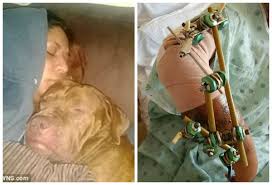 Jetonte me qen ne shtepi prej 9 vitesh, ai i kafshoi krahun deri sa ia këputi