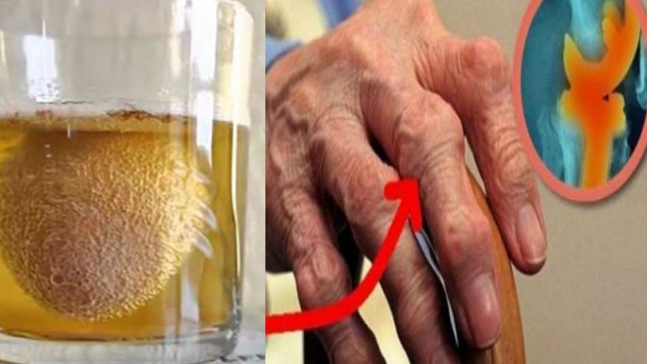 Për aq vite sa do jetoni nuk do keni më dhimbje në kocka, ja il’açi shtëpiak që ju duhet