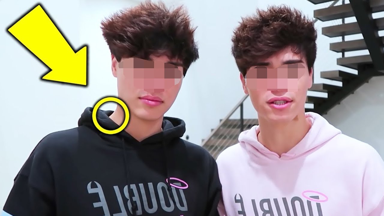 Doktori lexon rezultatet e ADN-së së binjakëve – Fytyra e tij zbehet para se të thotë vetëm një gjë