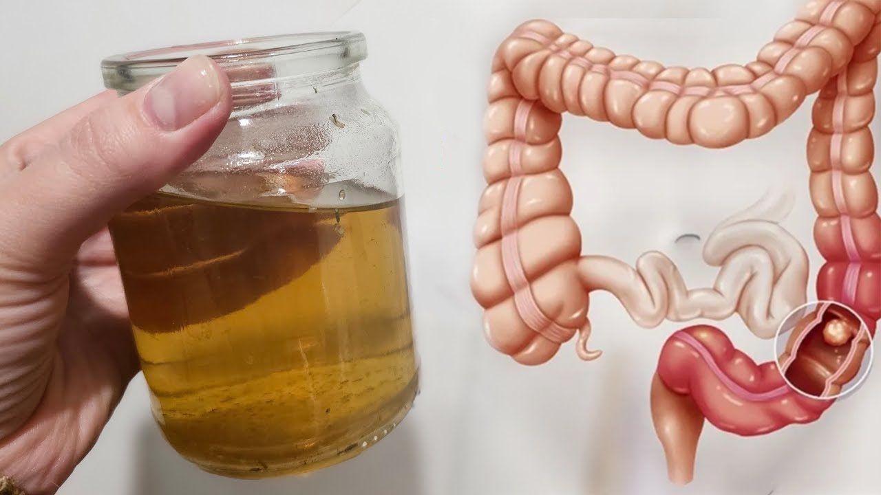 Pastroni tërësisht zorrën e trashë me këtë recetë që bën ‘mrekulli’ me trupin tuaj