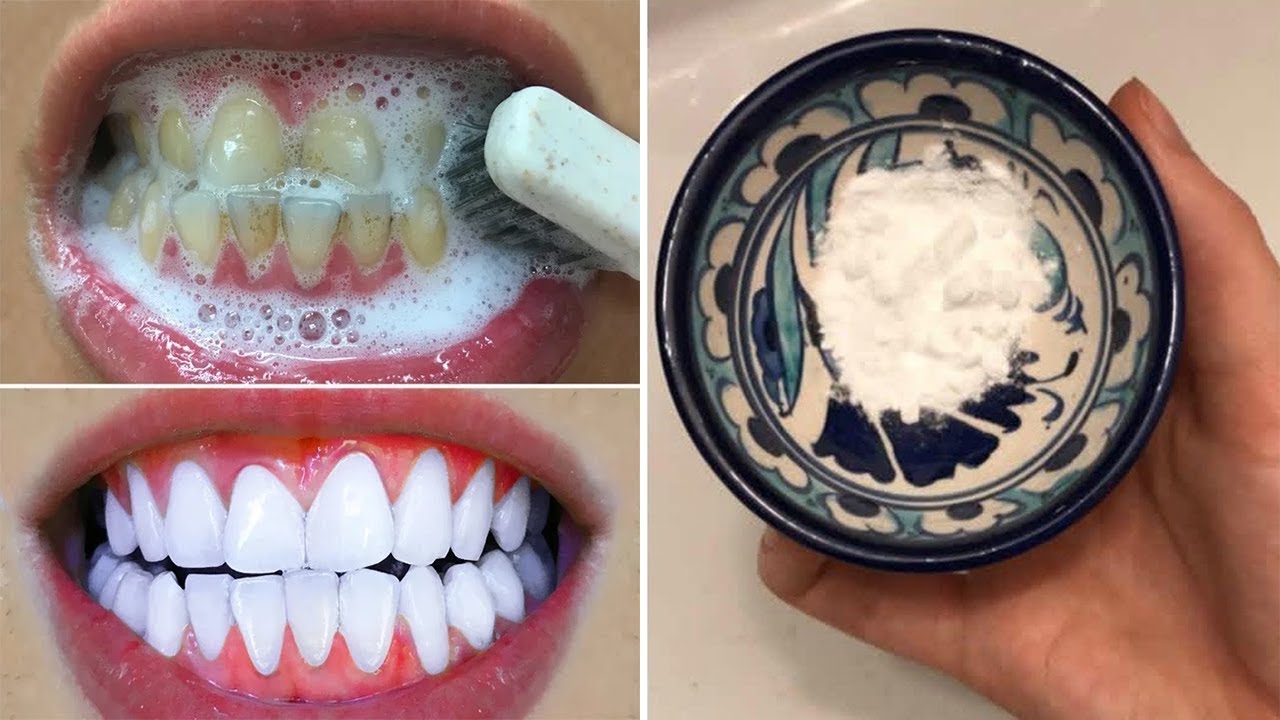Doni dhëmbë të bardhë si bora? Kjo metodë do ju lërë pa fjalë