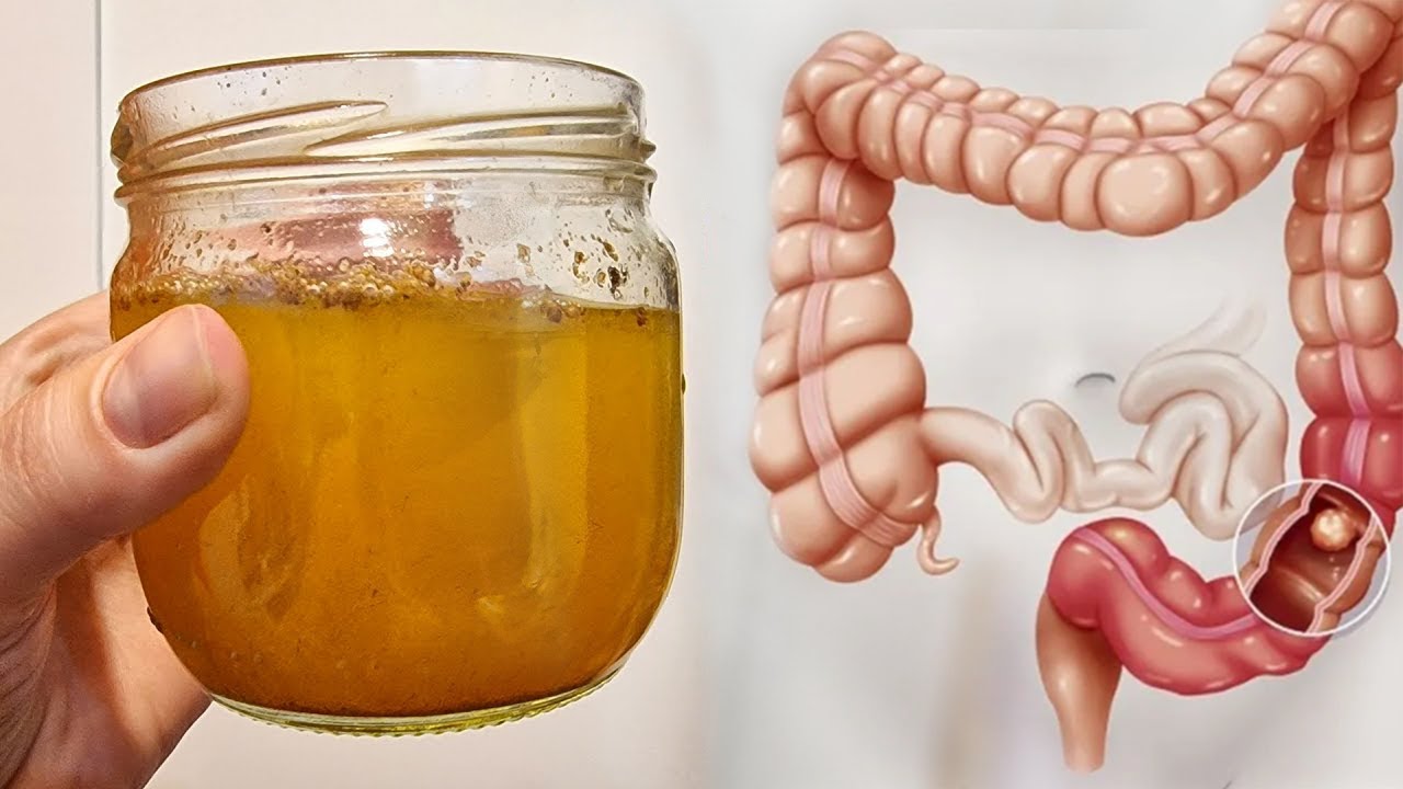 Pastroni zorrën e trashë dhe shpëtoni nga kapsllëku, kjo recetë do ju lërë pa fjalë