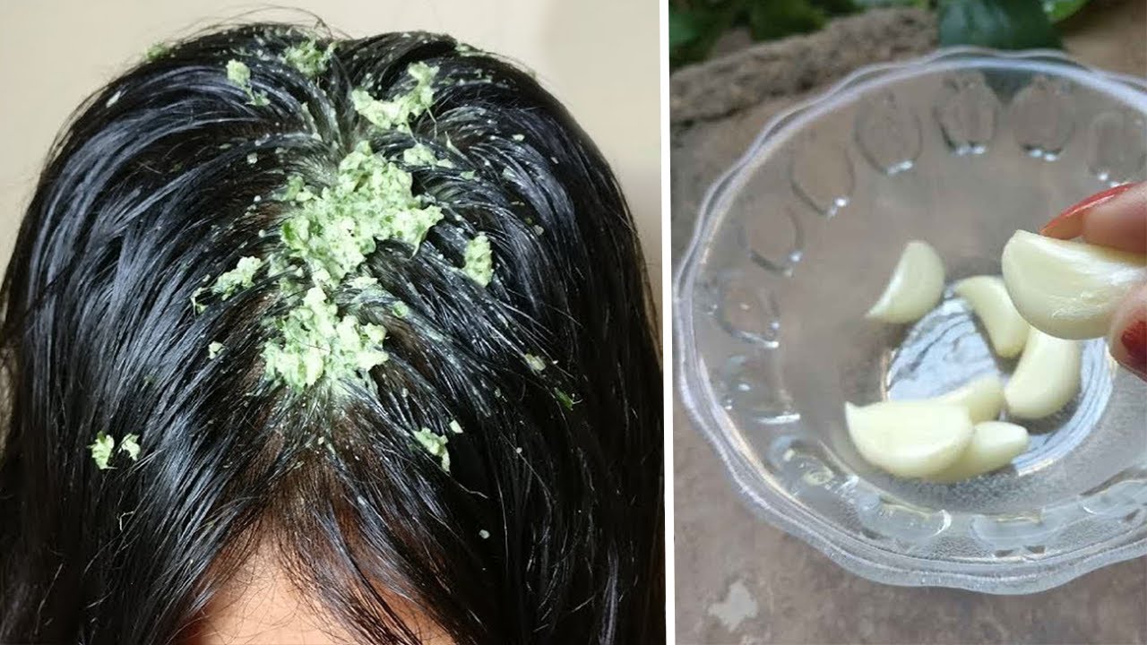 Kujt ja merrte mendja? Hudhra bën mrekulli për flokët, ja si ta përdorni