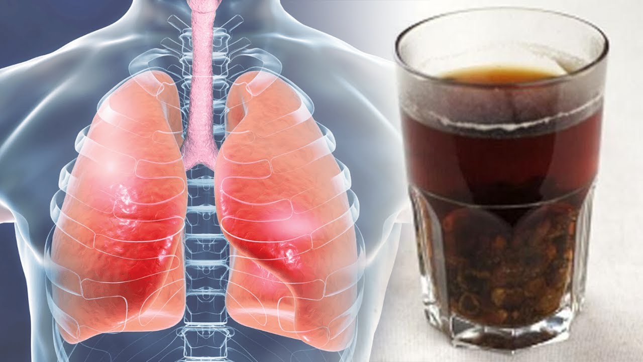 Më në fund u gjet zgjidhja, ja si të zhdukni kollën dhe të pastroni rrënjësisht mushkërit për 72 orë