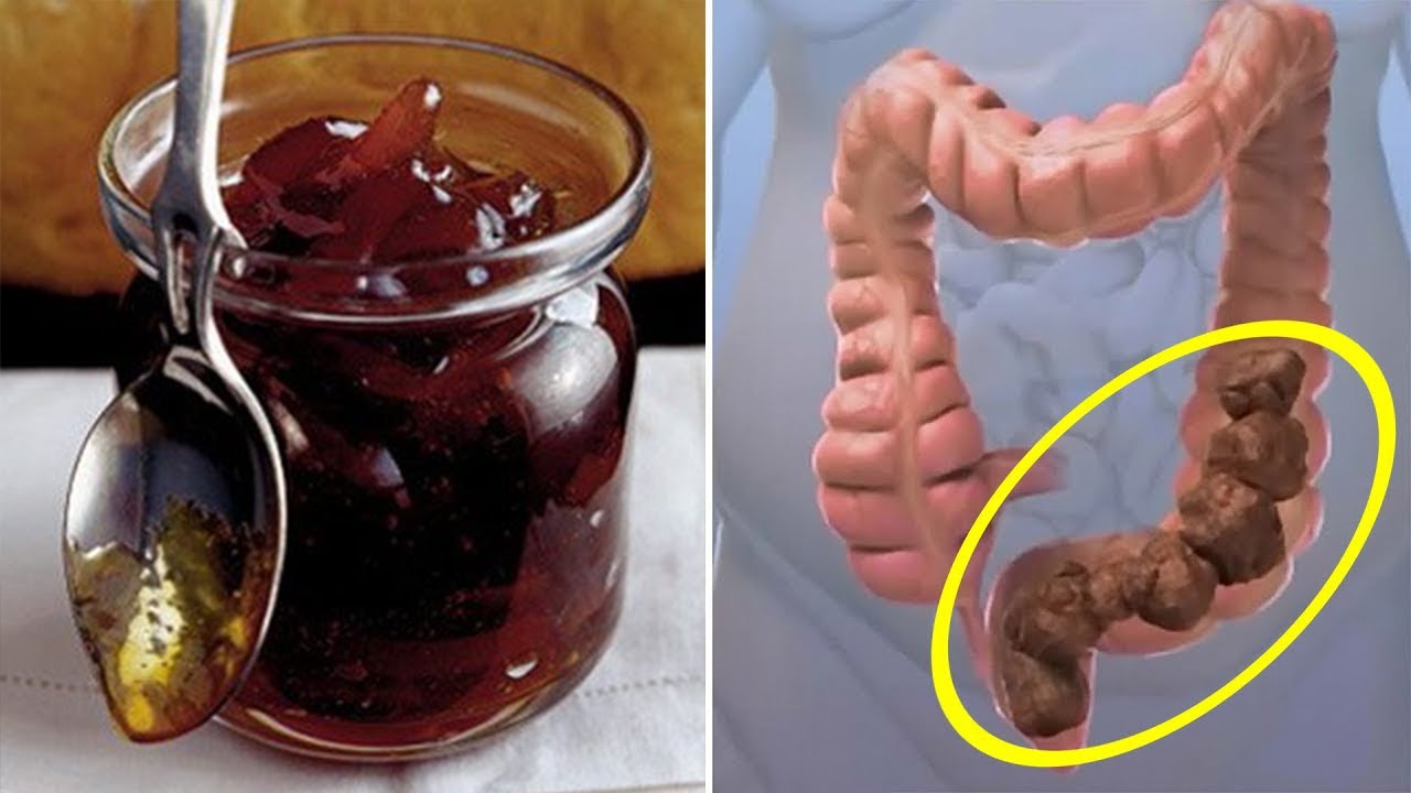 Si të largoni kapsllëkun dhe fryrjen brenda 1 minute sipas kësaj recete