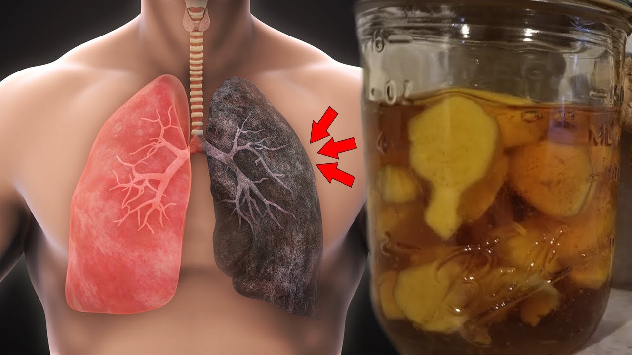 Më në fund u gjet zgjidhja, kjo recetë me mjaltë pastron “rrënjësisht” mushkëritë tuaja