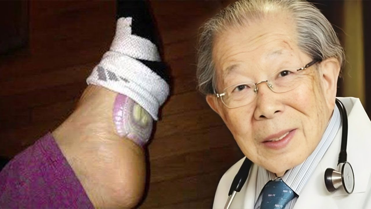 Vendosni një qepë poshtë këmbës gjatë natës dhe ajo çfarë i ndodh trupit tuaj do ju befasoj