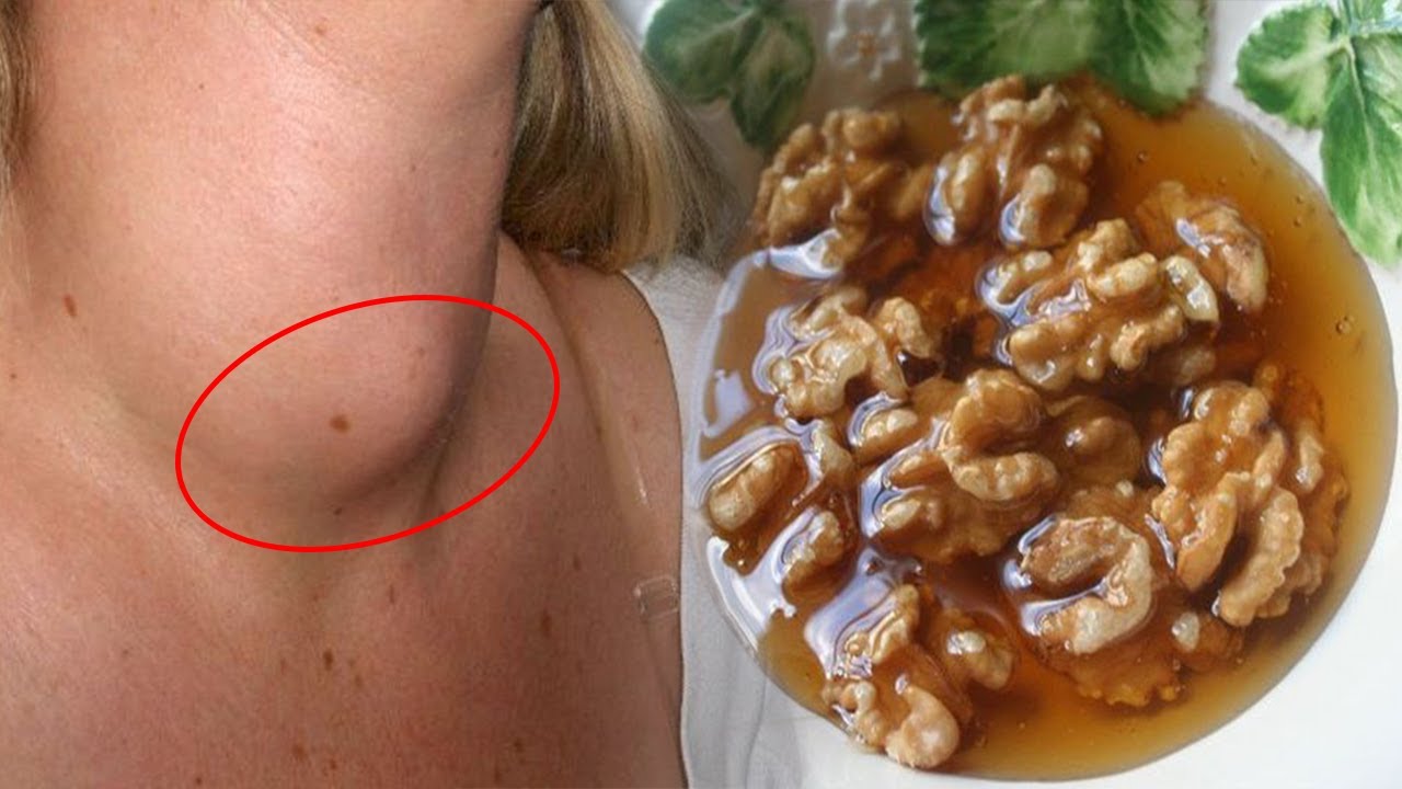 Mjekët jua kanë fshehur: Kjo është receta e vetme që shëron gjëndrën tiroide