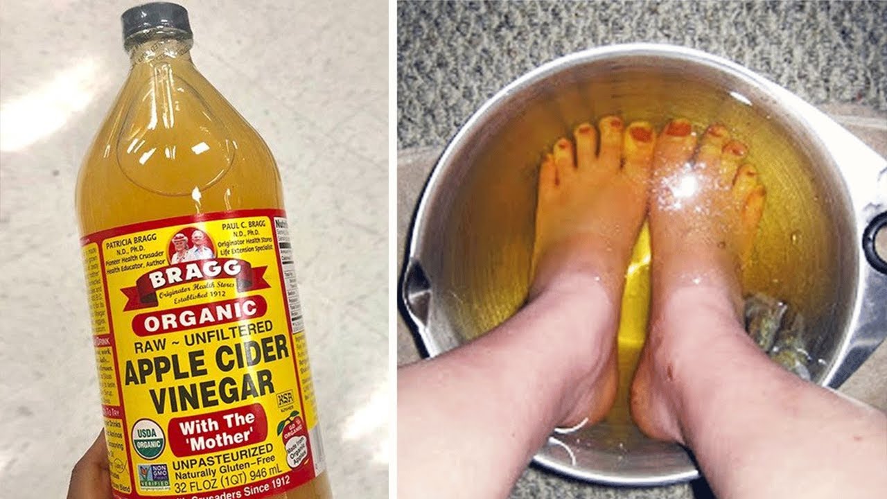 Fusni këmbët në uthull molle për 30 minuta në ditë dhe shikoni çfarë do të ndodhë