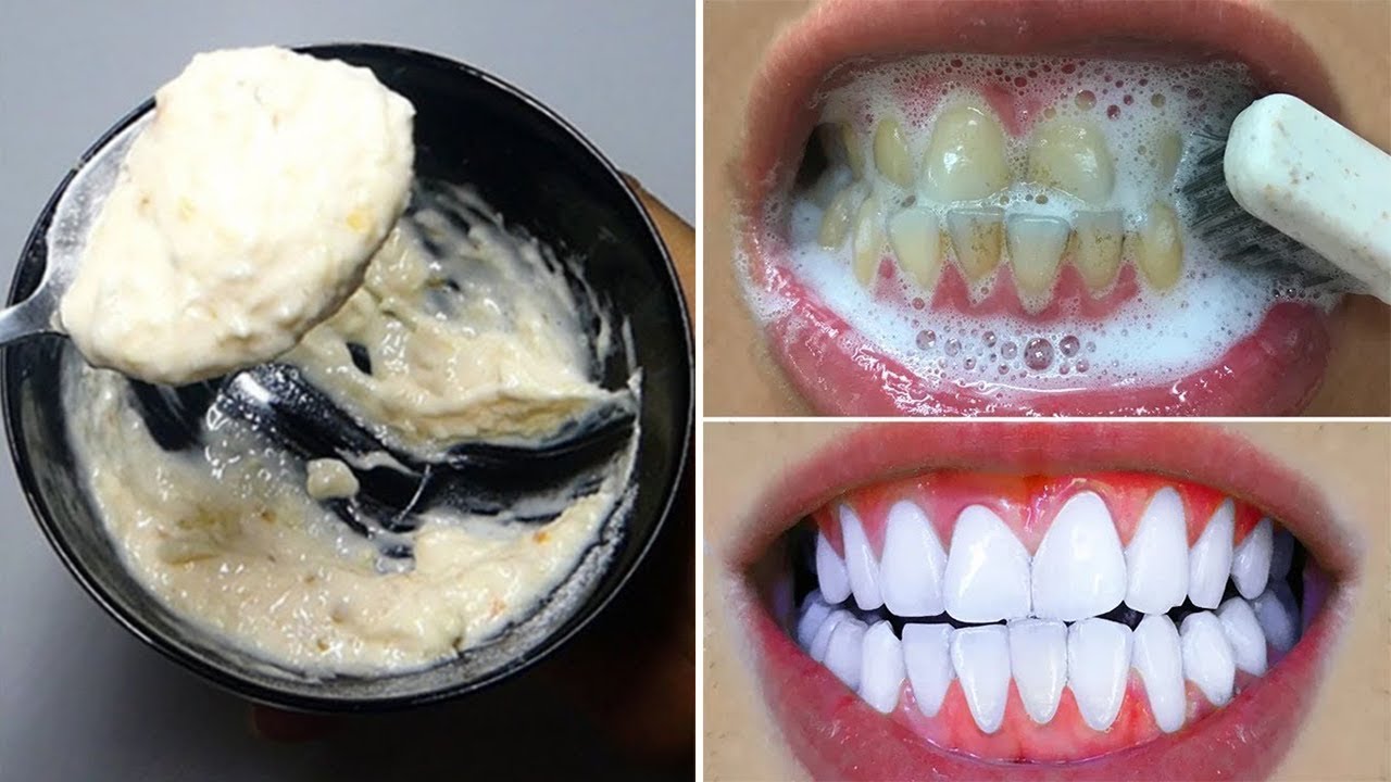 Nëse goja ju vjen erë, shkoni urgjent tek mjeku. Mund të vuani nga…