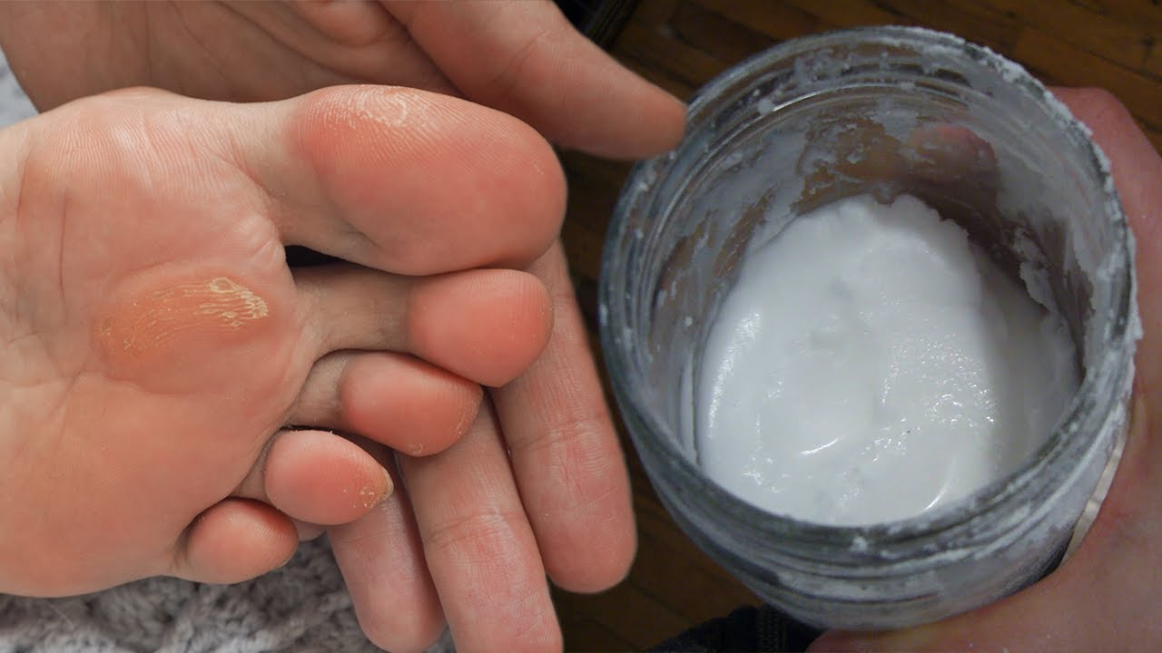 Me vetëm 1 kokërr aspirinë do shpëtoni nga problemi që vuajnë gratë mbas të 40-tave