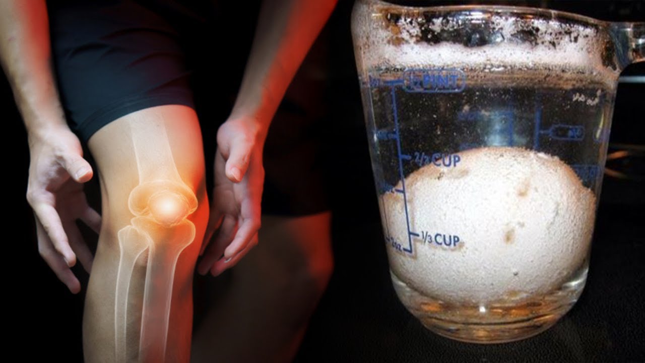 Keni dhimbje gjuri? Kjo recetë me 1 përbërës shëron dhimbjen përgjithmonë